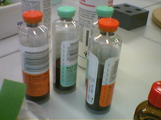 Blood Culture clinical medical diagnostic investigation