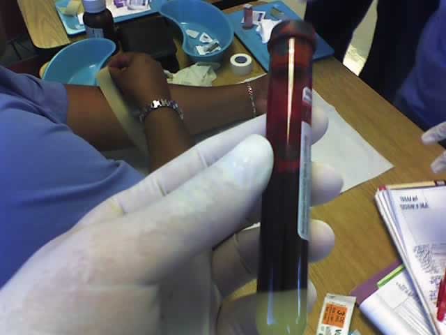 Hormone Panel (Testosterone, Estrogen, Cortisol, Prolactin, LH, FSH) clinical medical diagnostic investigation