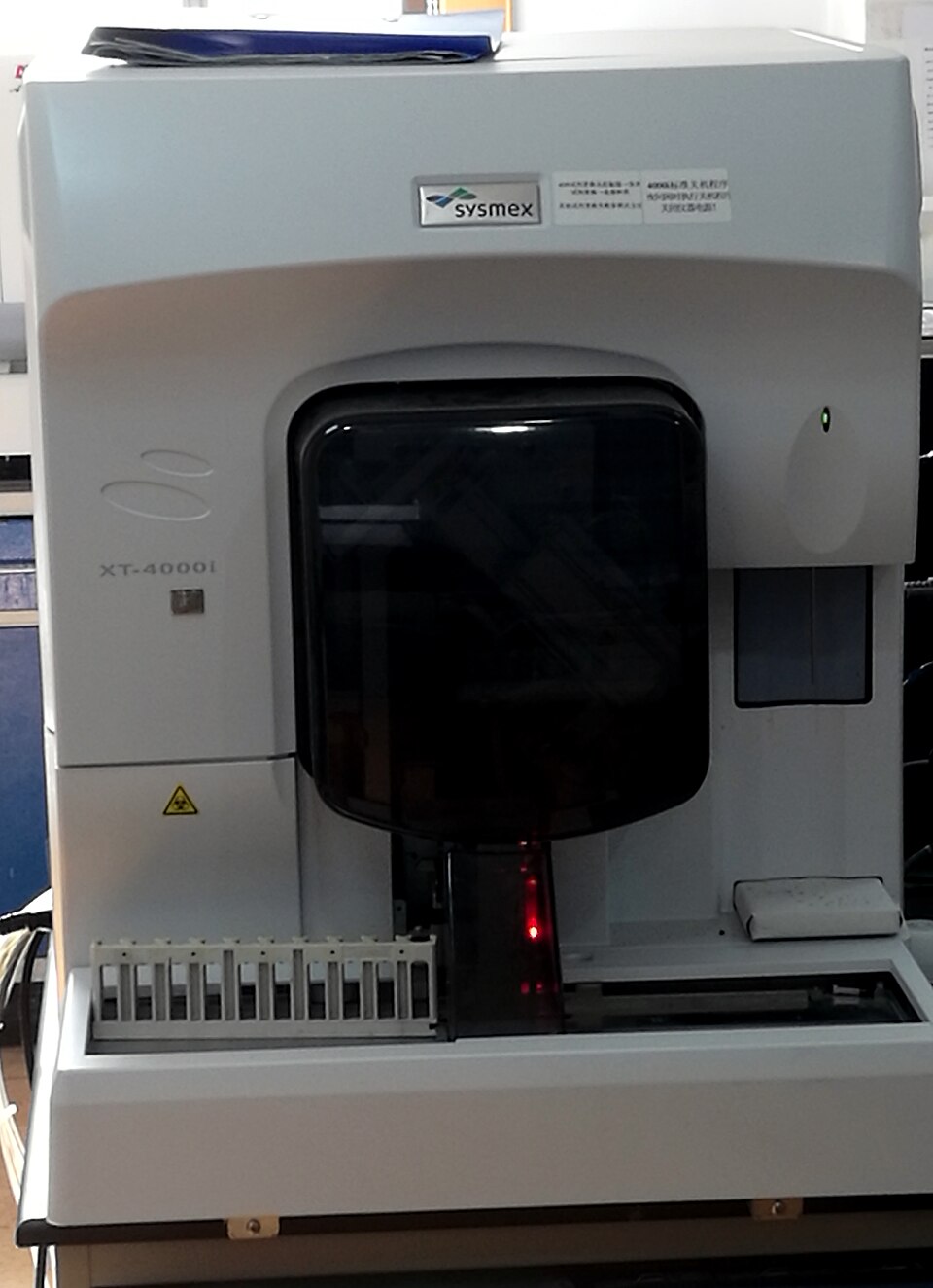 Iron Studies (Ferritin, Serum Iron, TIBC) clinical medical diagnostic investigation
