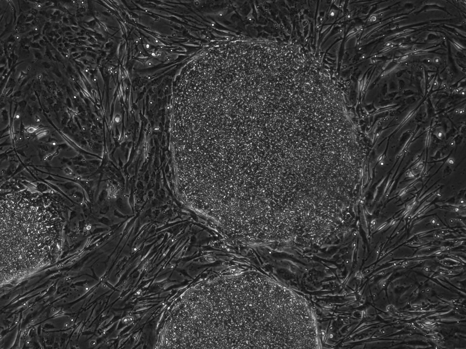 Osteoarthritis clinical reference photography