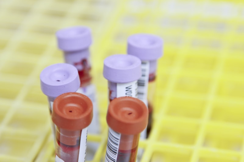 Thyroid Profile (TSH, T3, T4) diagnostic investigation and medical test