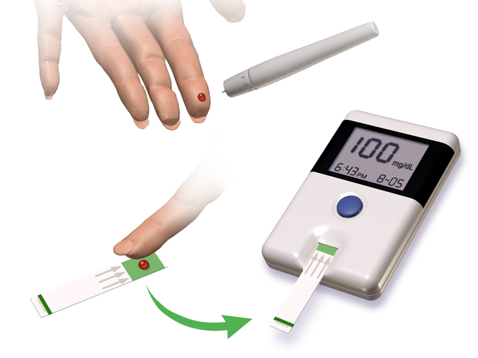 Type 2 Diabetes Mellitus clinical reference photography