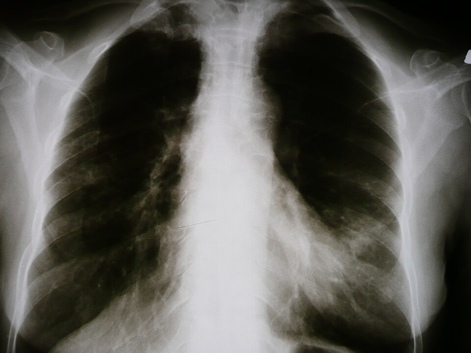 Vasculitis clinical reference photography