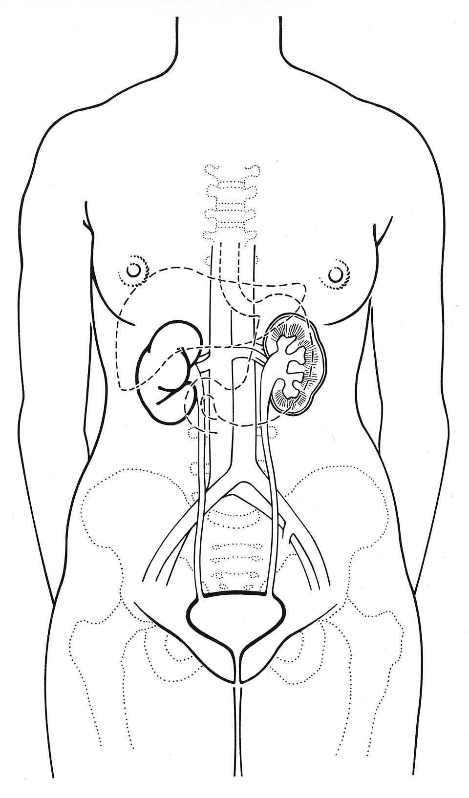 Cystitis clinical reference photography