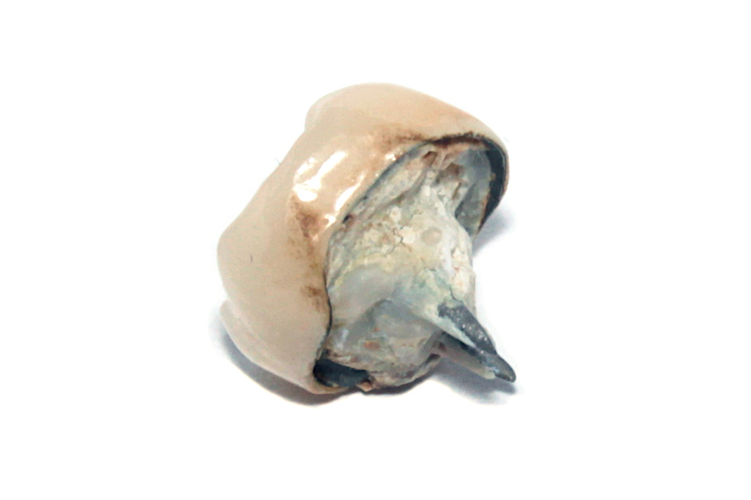 Pediatric dental anatomical model illustrating primary and permanent tooth development